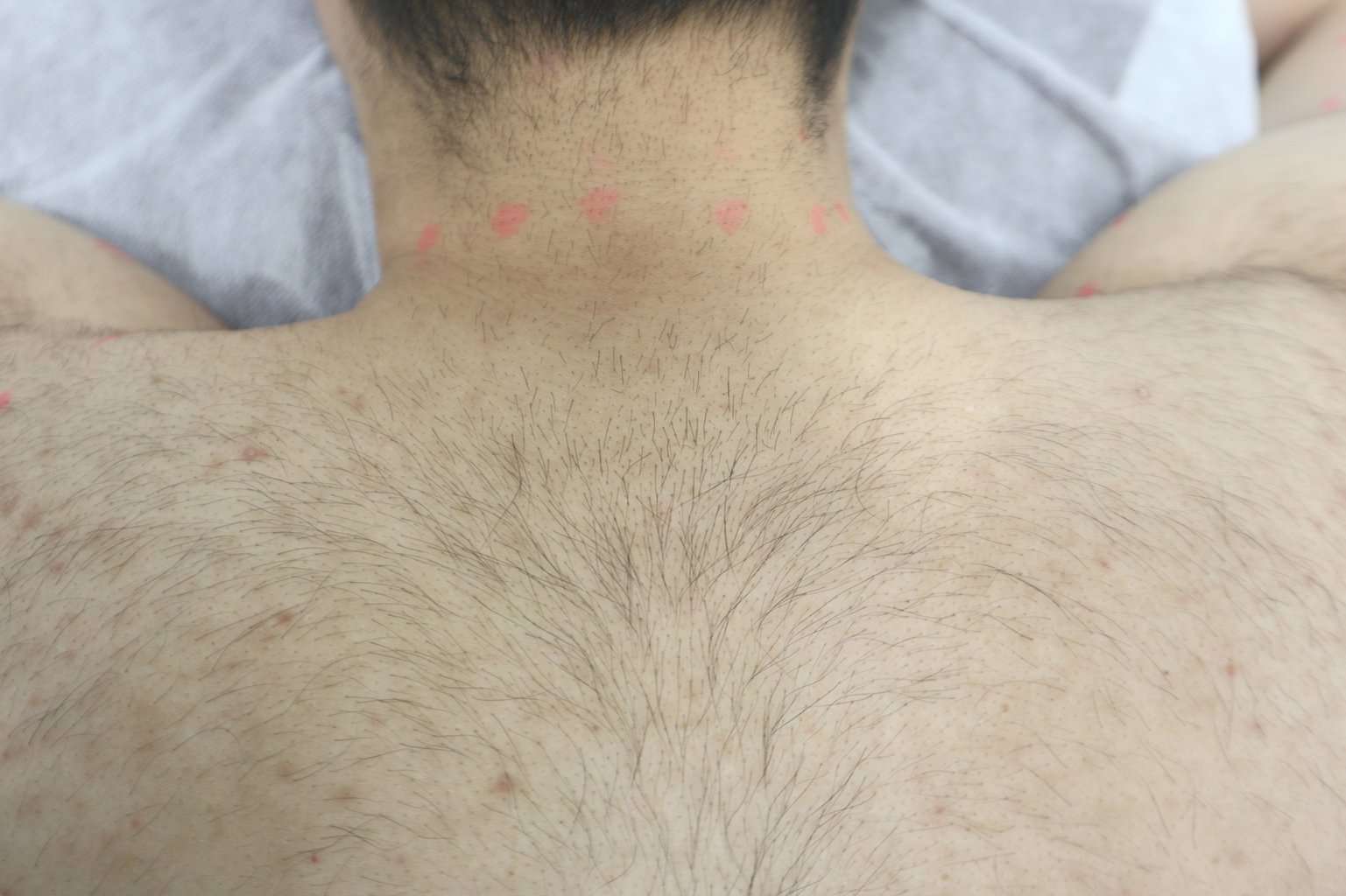 硬 毛 化