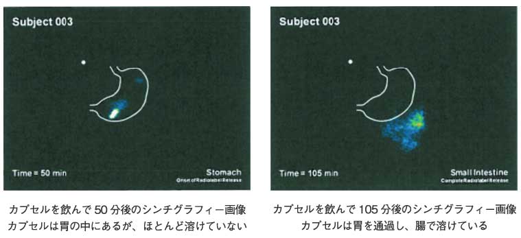 プラセンタ腸溶性カプセル