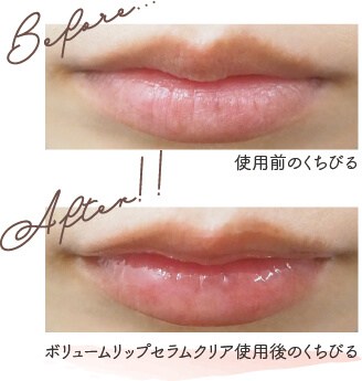 ボリュームリップセラム使用前後