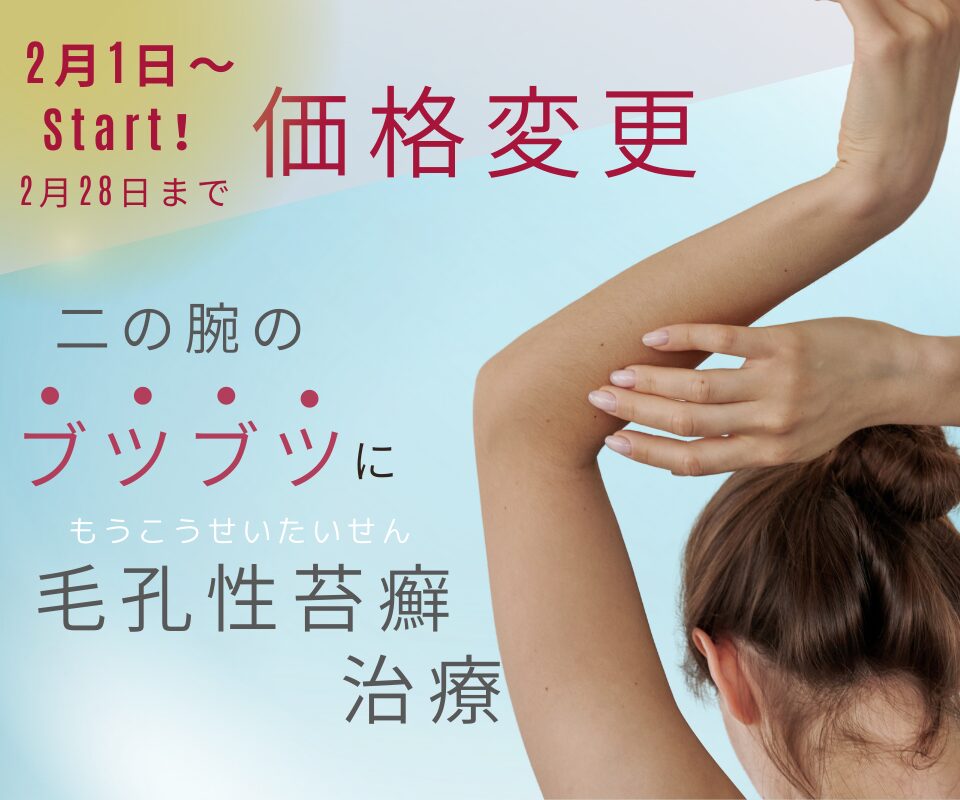 毛孔性苔癬治療ダーマペンの期間限定料金変更のお知らせ