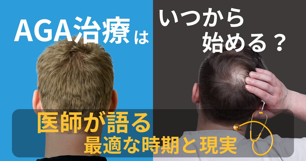 AGA治療はいつから始めるべきかを解説する医師監修記事。早期治療の効果や適切な開始時期を説明するイメージ