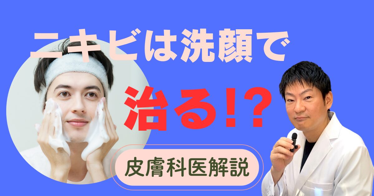 「ニキビは洗顔で治る！？」皮膚科医が解説する洗顔の真実 | 肌のクリニック高円寺院・麹町院