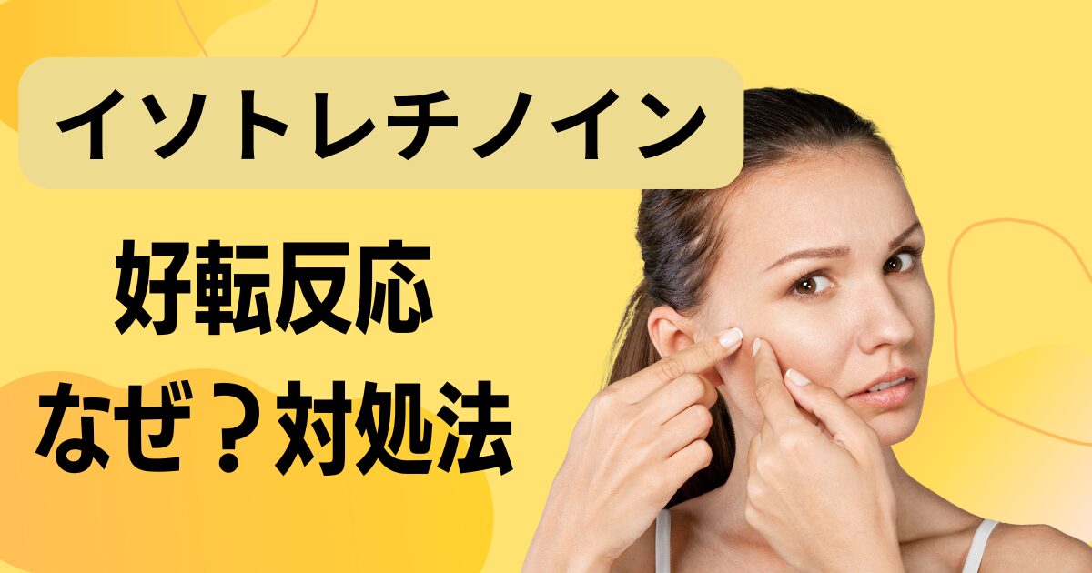 イソトレチノイン治療の好転反応：初期悪化の原因と効果的な対処法