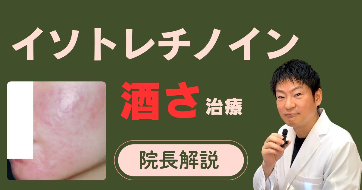 イソトレチノインによる酒さ（赤ら顔）治療の効果の解説