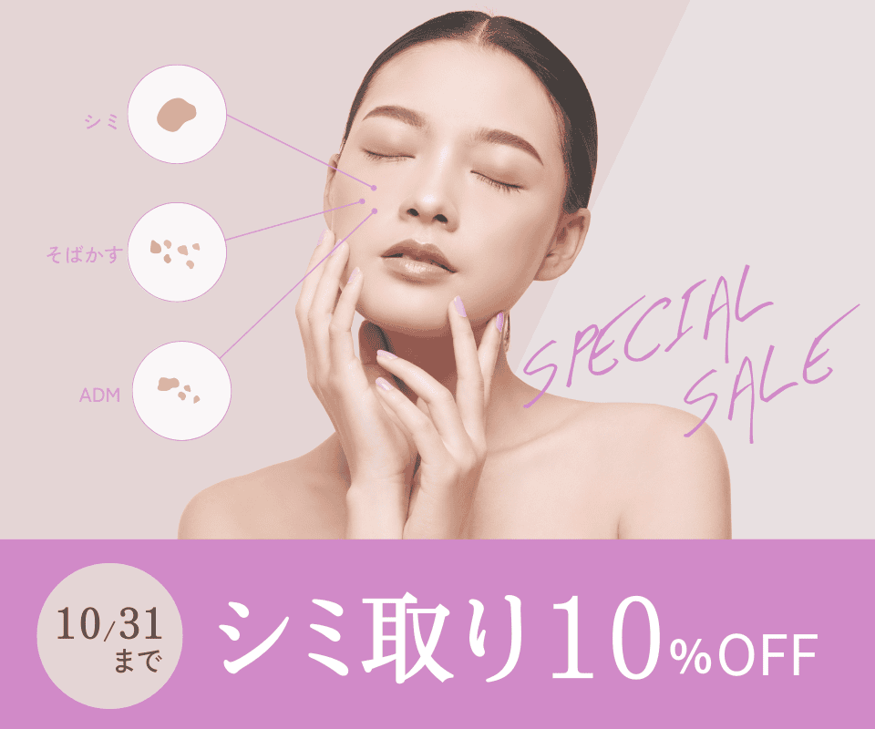 シミ取り10%OFFのご案内